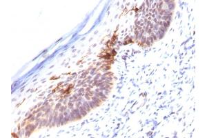 Formalin-fixed, paraffin-embedded human Skin stained with CD1a Monoclonal Antibody (SPM120). (CD1a 抗体)