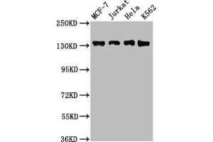 Western Blot Positive WB detected in: MCF-7 whole cell lysate, Jurkat whole cell lysate, Hela whole cell lysate, K562 whole cell lysate All lanes: WAPL antibody at 2. (WAPAL 抗体  (AA 1037-1190))