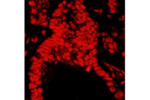 Immunofluorescence (IF) image for anti-Matrin 3 (MATR3) (C-Term) antibody (ABIN7455225)