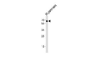 Western blot analysis of lysate from human pancreas tissue lysate, using ACVR2B Antibody (S14) A. (ACVR2B 抗体  (AA 1-30))