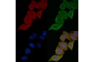 ABIN7095543 and ABIN7099600 staining Hela cells(45 min of heat-shock treatment) by IF/ICC.