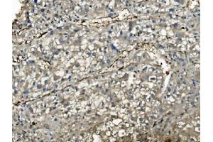 IHC analysis of PNP using anti-PNP antibody (ABIN7602997).