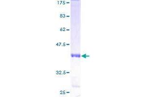 ZNF587 Protein (AA 1-122) (GST tag)