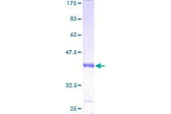 ZNF587 Protein (AA 1-122) (GST tag)
