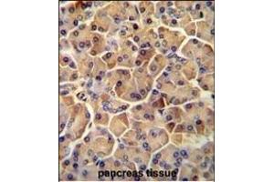 Immunohistochemistry (Paraffin-embedded Sections) (IHC (p)) image for anti-SEL1L adaptor subunit of ERAD E3 ubiquitin ligase (SEL1L) (AA 156-182) antibody (ABIN654642)
