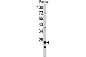 Western Blotting (WB) image for anti-Ribosomal Protein S9 (RPS9) antibody (ABIN3002715) (RPS9 抗体)