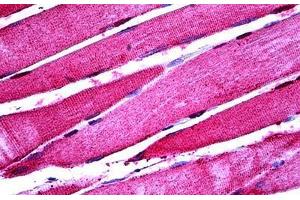 Human Skeletal Muscle: Formalin-Fixed, Paraffin-Embedded (FFPE) (ENO3 抗体  (AA 228-278))