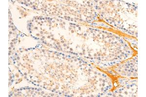 Immunohistochemistry (IHC) image for anti-Mitogen-Activated Protein Kinase Kinase Kinase 7 (MAP3K7) (pThr187) antibody (ABIN6256492)