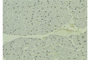 anti-Ubiquitin Specific Peptidase 22 (USP22) (Internal Region) antibody