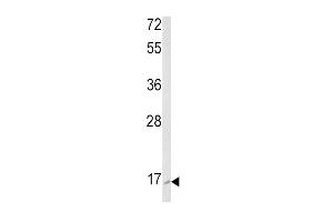 Western Blotting (WB) image for anti-Ras-Related C3 Botulinum Toxin Substrate 2 (Rho Family, Small GTP Binding Protein Rac2) (RAC2) (AA 164-188), (C-Term) antibody (ABIN652785)