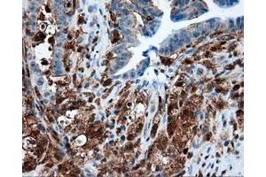Immunohistochemical staining of paraffin-embedded Kidney tissue using anti-RC219453 mouse monoclonal antibody. (NPR3 抗体)
