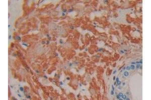 DAB staining on IHC-P; Samples: Human Prostate Tissue (IFNA7 抗体  (AA 24-189))