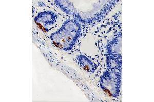 Immunohistochemical analysis of paraffin-embedded R. (LYZ 抗体  (C-Term))