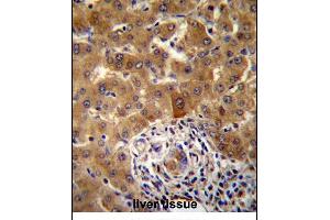 PHF17 Antibody (N-term) (ABIN657355 and ABIN2846405) immunohistochemistry analysis in formalin fixed and paraffin embedded human liver tissue followed by peroxidase conjugation of the secondary antibody and DAB staining. (PHF17 抗体  (N-Term))