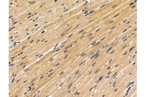 ABIN6256860 and ABIN6274329 at 1/100 staining Rat heart tissue by IHC-P. (FOXC1 抗体  (Internal Region))