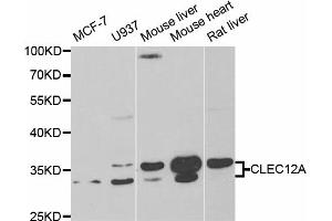 Western blot analysis of extracts of various cell lines, using CLEC12A antibody. (CLEC12A 抗体)