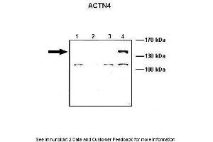 Lanes:   Lane1: 10 ug ACTN1-GFP transfected COS-7 lysate Lane2: 10 ug ACTN2-GFP transfected COS-7 lysate Lane3: 10 ug ACTN3-GFP transfected COS-7 lysate Lane4: 10 ug ACTN4-GFP transfected COS-7 lysate  Primary Antibody Dilution:   1: 1000  Secondary Antibody:   Anti-rabbit HRP  Secondary Antibody Dilution:   1:5000  Gene Name:   ACTN4  Submitted by:   Johannes W. (alpha Actinin 4 抗体  (C-Term))