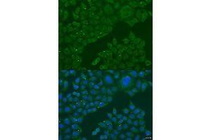 Immunofluorescence analysis of U2OS cells using B3GALNT1 antibody (ABIN2736338) at dilution of 1:100. (B3GALNT1 抗体)