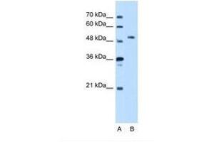 Image no. 1 for anti-serine threonine Kinase 39 (STK39) (AA 151-200) antibody (ABIN321508) (STK39 抗体  (AA 151-200))