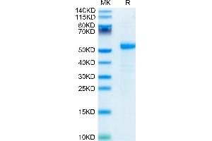 SDS-PAGE (SDS) image for delta Like Protein 3 (DLL3) (AA 27-490) protein (His tag) (ABIN7274482)