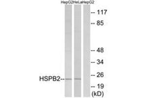 Western blot analysis of extracts from HepG2/HeLa cells, using HSPB2 Antibody. (HSPB2 抗体  (AA 121-170))