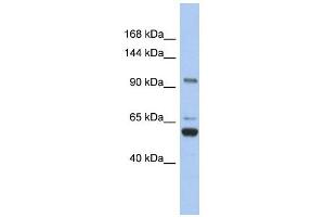TRPM8 antibody used at 1 ug/ml to detect target protein. (TRPM8 抗体  (N-Term))