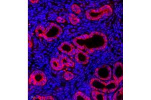 Immunofluorescence of paraffin embedded mouse uterus using CK13 (ABIN7074411) at dilution of 1:500 (400x lens) (Cytokeratin 13 抗体  (C-Term))
