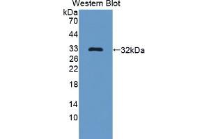 Detection of Recombinant Bcl11A, Human using Polyclonal Antibody to B-Cell CLL/Lymphoma 11A (Bcl11A) (BCL11A 抗体  (AA 1-210))