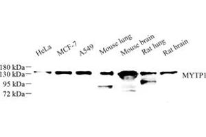 Western blot analysis of MYTP1 (ABIN7074731) at dilution of 1: 500 (Myosin Binding Subunit 抗体)