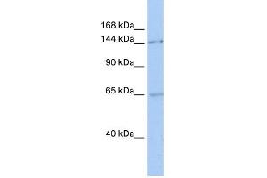 WB Suggested Anti-SMC1A Antibody Titration:  0. (SMC1A 抗体  (C-Term))