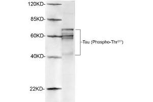 Western blot analysis of rat brain lysates using 1 µg/mL Antibodies-Online Rabbit Anti-Tau (Phospho-Thr217) Polyclonal Antibody (ABIN398308) The signal was developed with IRDyeTM 800 Conjugated Goat Anti-Rabbit IgG. (tau 抗体  (pThr217))
