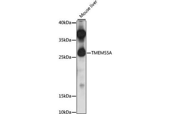 TMEM55A Antikörper  (AA 130-195)