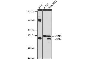 Western blot analysis of extracts of various cell lines, using STING antibody (ABIN7270958) at 1:1000 dilution. (STING/TMEM173 抗体)