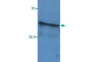 Western Blotting analysis (reducing conditions) of whole cell lysate of Sp2/0 mouse myeloma cell line using BLNK polyclonal antibody . (B-Cell Linker 抗体  (AA 171-356))
