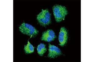 Confocal immunofluorescent analysis of CHAT antibody with NCI-H460 cells followed by Alexa Fluor 488-conjugated goat anti-rabbit lgG (green). (Choline Acetyltransferase 抗体  (AA 98-128))