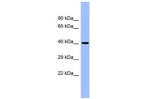 WB Suggested Anti-CEACAM6 Antibody Titration:  0. (CEACAM6 抗体  (N-Term))