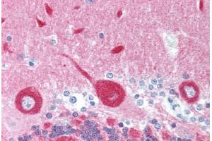 Human Brain, Cerebellum (formalin-fixed, paraffin-embedded) stained with FREQ antibody ABIN214036 at 5 ug/ml followed by biotinylated goat anti-rabbit IgG secondary antibody ABIN481713, alkaline phosphatase-streptavidin and chromogen. (NCS1 抗体)