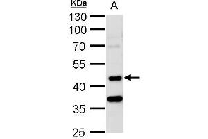 WB Image STK24 antibody [N2C1], Internal detects STK24 protein by western blot analysis. (STK24 抗体)