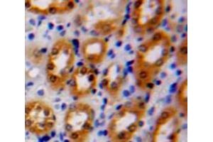 Used in DAB staining on fromalin fixed paraffin-embedded Kidney tissue (MOK 抗体  (AA 2-228))