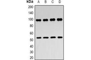 Western blot analysis of ZASP expression in Hela (A), MCF7 (B), mouse skeletal muscle (C), rat skeletal muscle (D) whole cell lysates. (LIM Domain Binding 3 Protein 抗体)