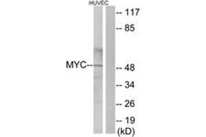 Western blot analysis of extracts from HuvEc cells, using MYC Antibody. (c-MYC 抗体  (AA 386-435))