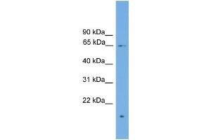 Human MCF-7; WB Suggested Anti-ZNF320 Antibody Titration: 0. (ZNF320 抗体  (N-Term))