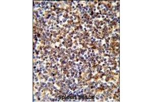 Immunohistochemistry (Paraffin-embedded Sections) (IHC (p)) image for anti-Coactosin-Like Protein (AA 115-142), (C-Term) antibody (ABIN652766)