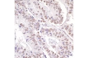 Immunohistochemistry (IHC) image for anti-PYD (Pyrin Domain) Containing 1 (PYDC1) (AA 1050-1100) antibody (ABIN7454625)