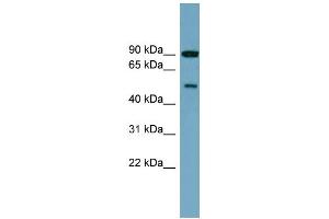 WB Suggested Anti-PI4K2B Antibody Titration: 0. (PI4K2B 抗体  (Middle Region))