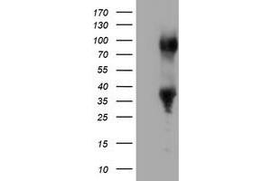 HEK293T cells were transfected with the pCMV6-ENTRY control (Left lane) or pCMV6-ENTRY ERCC1 (Right lane) cDNA for 48 hrs and lysed. (ERCC1 抗体)