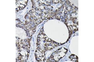 Immunohistochemistry (IHC) image for anti-Glutathione S-Transferase kappa 1 (GSTK1) (AA 1-226) antibody (ABIN1680136)