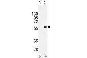 Western blot analysis of PKMYT1 (arrow) using rabbit polyclonal PKMYT1 C-term (ABIN391292 and ABIN2841332). (PKMYT1 抗体  (C-Term))