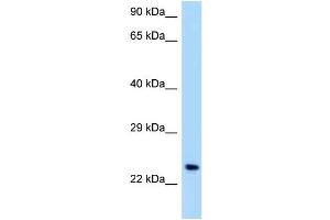 WB Suggested Anti-OSCAR Antibody Titration: 1. (OSCAR 抗体  (C-Term))