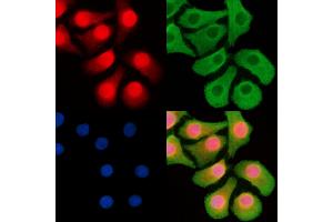 ABIN6263498 and ABIN6268752 staining Hela cells by IF/ICC. (MYCN 抗体  (Internal Region))